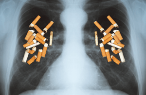 lung-smoking-copd