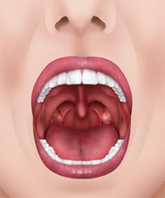 mouthAirway