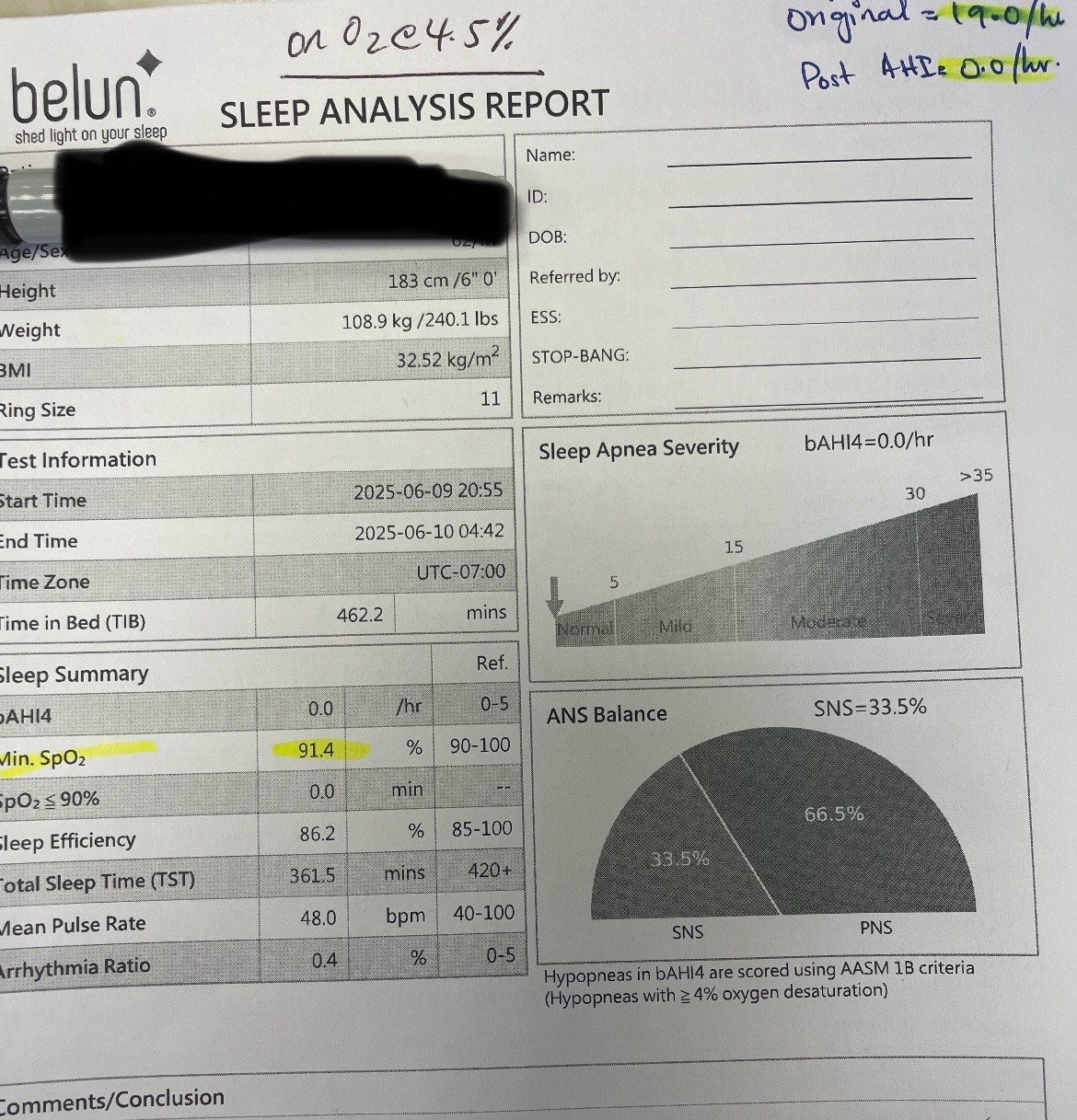 Post dental sleep Herbst treatment sleep study