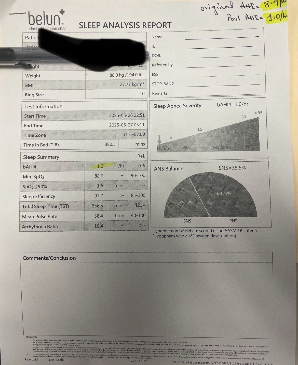 After sleep result for patient number three